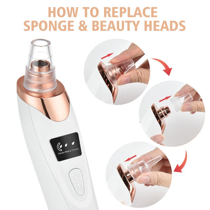 Electric Vacuum Blackhead Remover